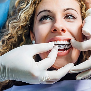 A young woman having new Invisalign trays placed