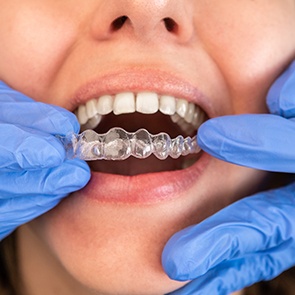 Woman getting Invisalign