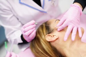 Medical professional carefully performing a thread lift